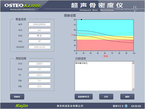 超声骨密度仪参数说明